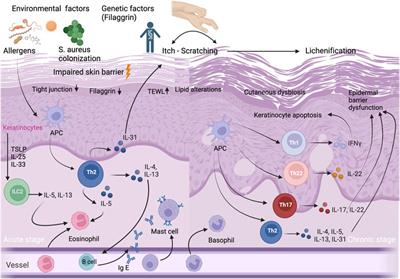 The immunological and structural epidermal barrier dysfunction and skin microbiome in atopic dermatitis-an update